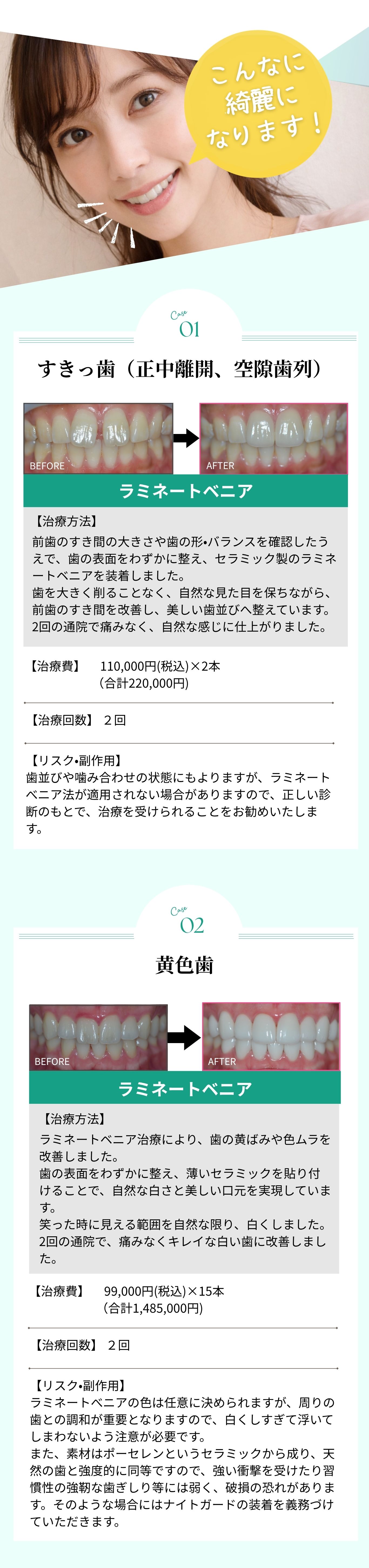 症例紹介 - すきっ歯、黄色歯の治療例